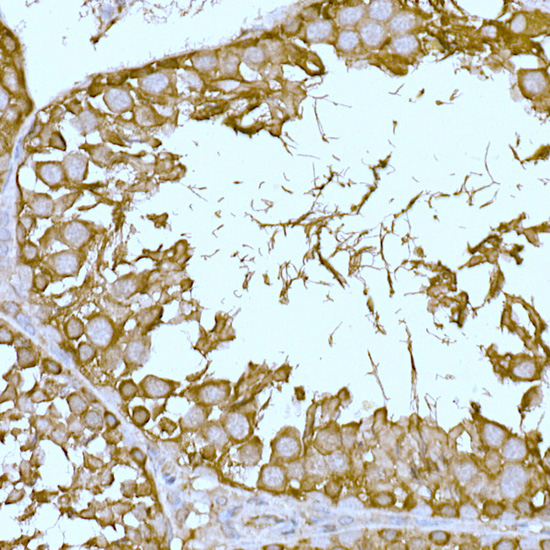 Immunohistochemistry of paraffin-embedded rat testis using SLC7A1 Rabbit pAb  at dilution of 1:100 