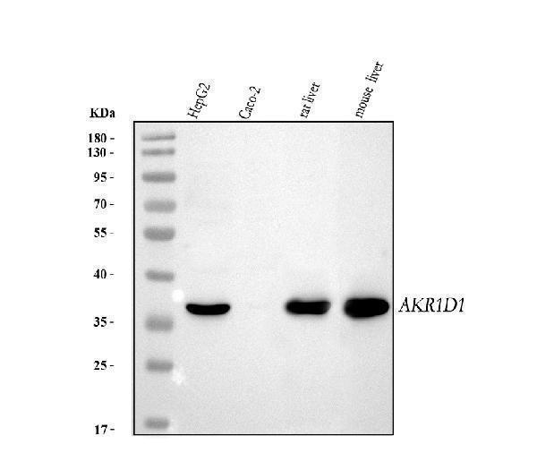  Western blot analysis of AKR1D1 using anti-AKR1D1 antibody (A05278-1)