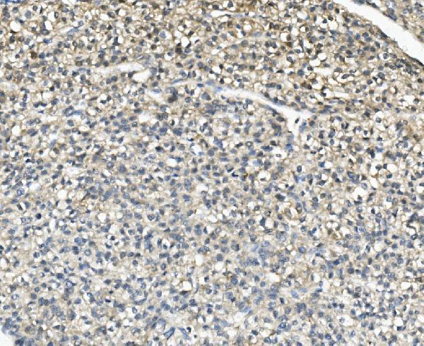  IHC analysis of AKR1D1 using anti-AKR1D1 antibody (A05278-2)