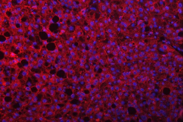 a05279 3 septin9 primary antibodies if testing 6