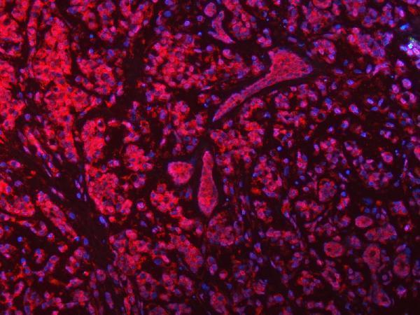 a05279 3 septin9 primary antibodies if testing 7