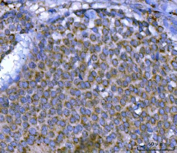  IHC analysis of MSF/SEPTIN9 using anti-MSF/SEPTIN9 antibody (A05279-3)