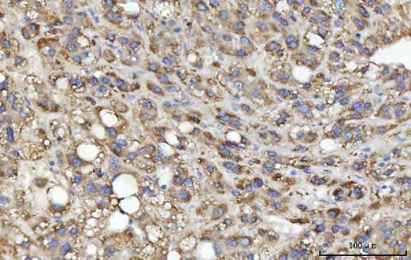  IHC analysis of MSF/SEPTIN9 using anti-MSF/SEPTIN9 antibody (A05279-3)