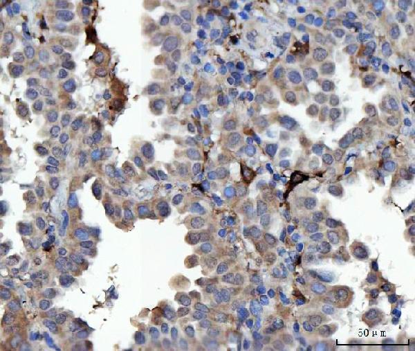 a05279 3 septin9 primary antibodies ihc testing 4