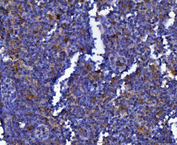 a05279 3 septin9 primary antibodies ihc testing 5