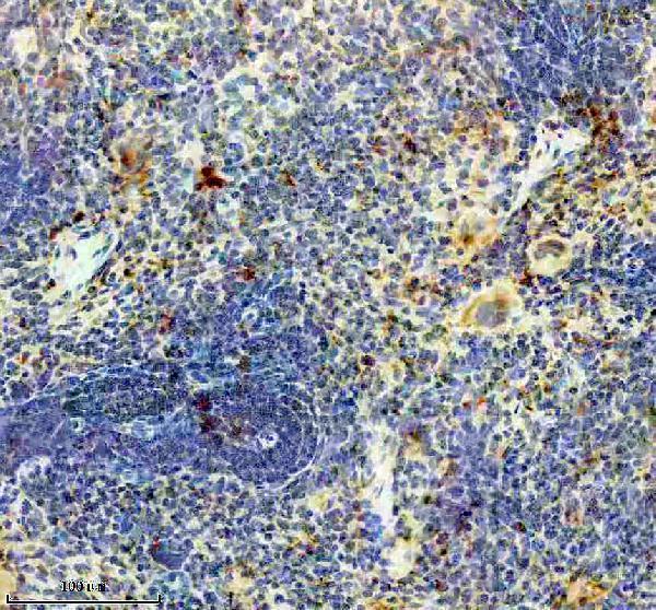 IHC analysis of RNASET2 using anti-RNASET2 antibody (A05281-1)