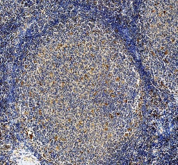 IHC analysis of RNASET2 using anti-RNASET2 antibody (A05281-1)