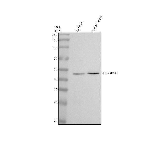 Western blot analysis of RNASET2 using anti-RNASET2 antibody (A05281-1)