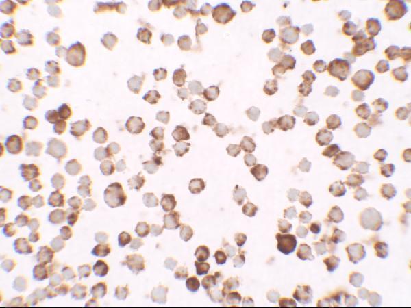 a05281 rnaset2 primary antibodies icc testing 2