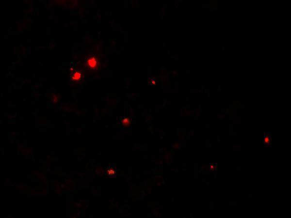 a05281 rnaset2 primary antibodies if testing 3
