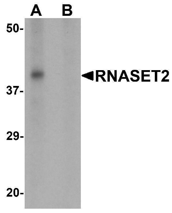 a05281 rnaset2 primary antibodies wb testing 1
