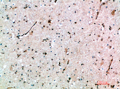 a05282 1 avpr1b primary antibodies ihc testing 1