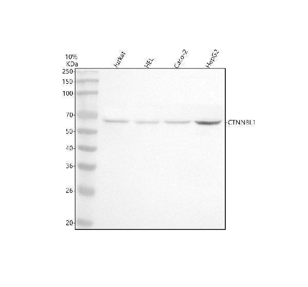  Western blot analysis of CTNNBL1 using anti-CTNNBL1 antibody (A05286-1)