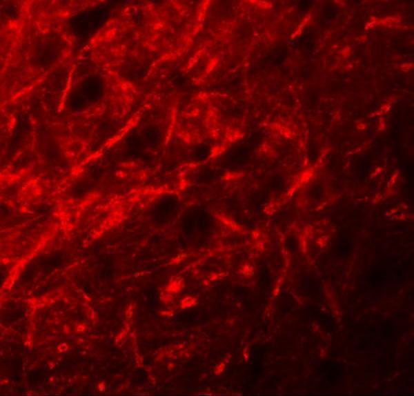 Immunofluorescence of CTNNBL1 in mouse brain tissue with CTNNBL1 antibody at 20 μg/mL