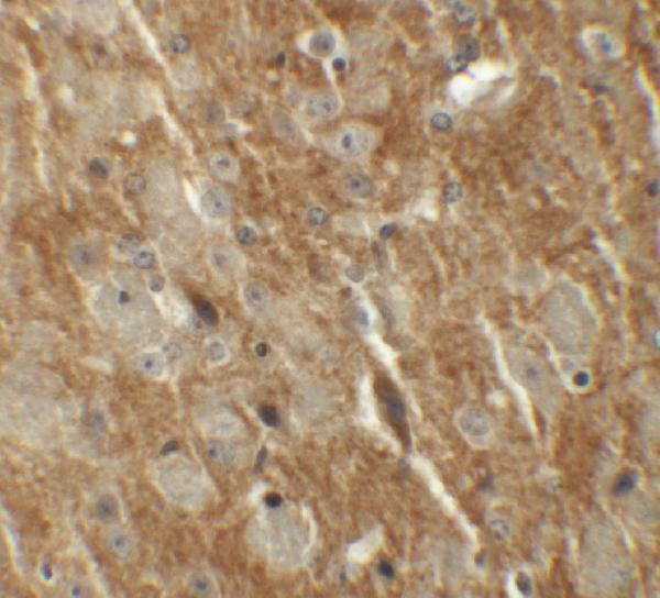 Immunohistochemistry of CTNNBL1 in mouse brain tissue with CTNNBL1 antibody at 5 μg/mL