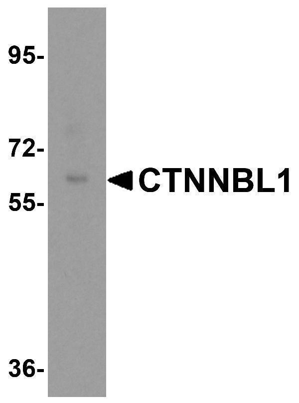 Western blot analysis of CTNNBL1 in human brain tissue lysate with CTNNBL1 antibody at 0