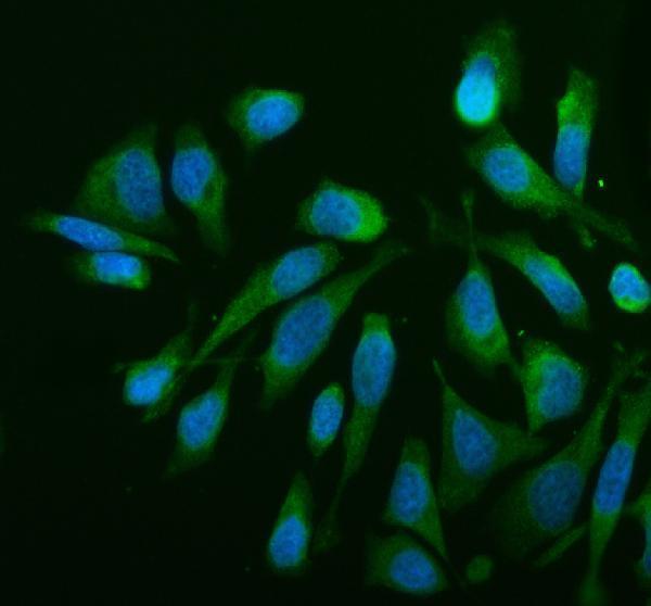 a05288 1 mtch2 primary antibodies if testing 5