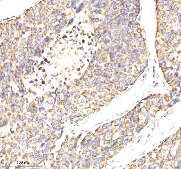  IHC analysis of MTCH2 using anti-MTCH2 antibody (A05288-1)