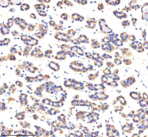  IHC analysis of MTCH2 using anti-MTCH2 antibody (A05288-1)