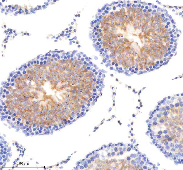 a05288 1 mtch2 primary antibodies ihc testing 4