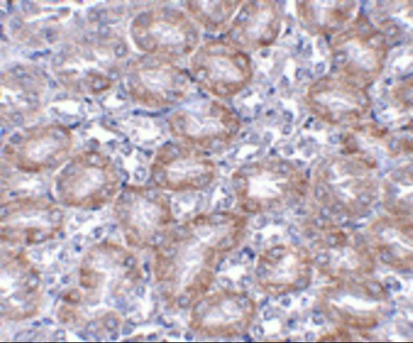 a05288 mtch2 primary antibodies ihc testing 2