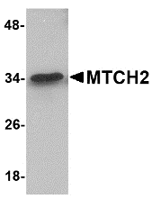 a05288 mtch2 primary antibodies wb testing 1