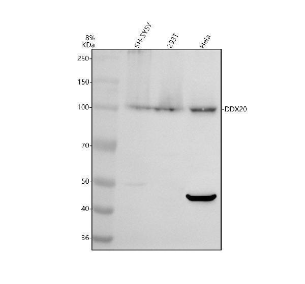 Western blot analysis of DDX20 using anti-DDX20 antibody (A05291-3)