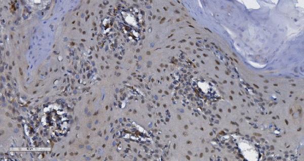 a05292 1 cdk13 primary antibodies ihc testing 4