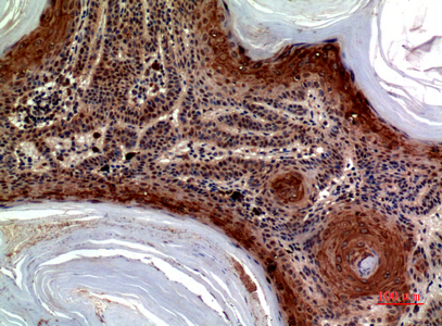 Immunohistochemical analysis of paraffin-embedded human-skin, antibody was diluted at 1:100
