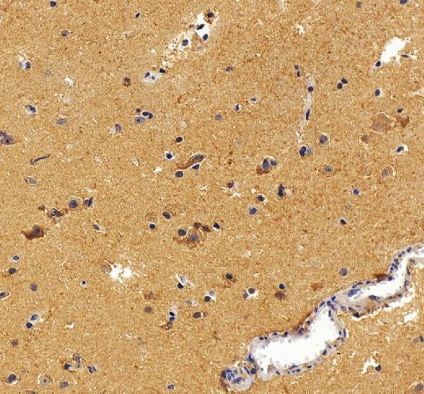 IHC analysis of Aldolase C/ALDOC using anti-Aldolase C/ALDOC antibody (A05296-1)