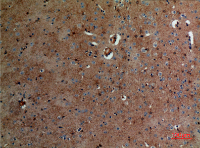 a05296 aldoc primary antibodies ihc testing 1