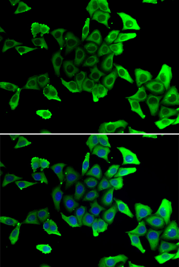 Immunofluorescence analysis of U20S cell using SGCD antibody