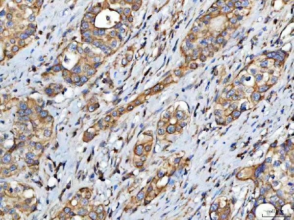  IHC analysis of FATP4/SLC27A4 using anti-FATP4/SLC27A4 antibody (A05299-2)