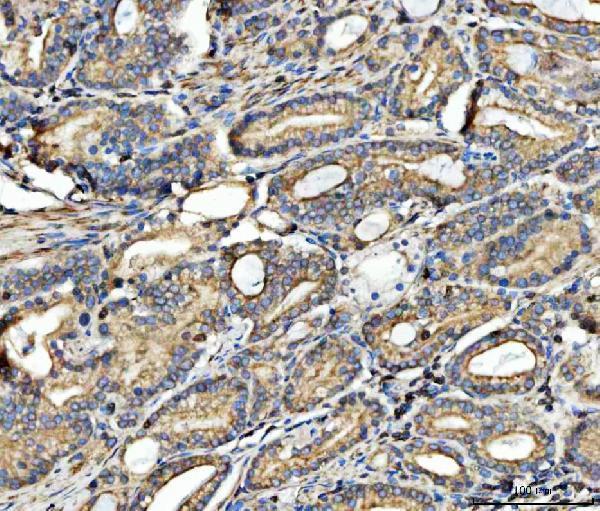 a05299 2 slc27a4 primary antibodies ihc testing 3