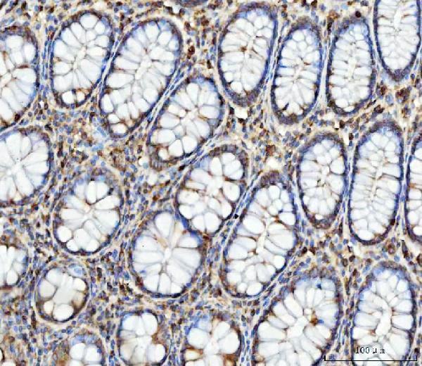 a05299 2 slc27a4 primary antibodies ihc testing 4