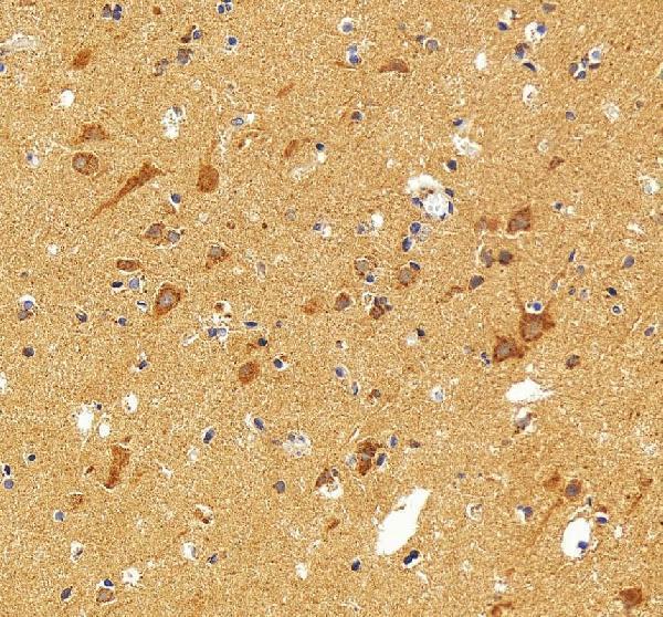 IHC analysis of FATP4/SLC27A4 using anti-FATP4/SLC27A4 antibody (A05299-2)