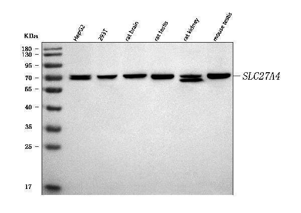  Western blot analysis of FATP4/SLC27A4 using anti-FATP4/SLC27A4 antibody (A05299-2)