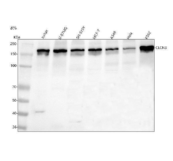  Western blot analysis of CLCN3 using anti-CLCN3 antibody (A05300-1)