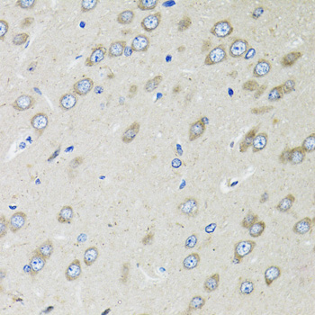 Immunohistochemistry of paraffin-embedded rat brain using OGDH antibody  at dilution of 1:100 