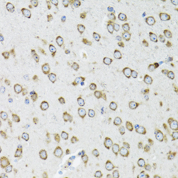 Immunohistochemistry of paraffin-embedded mouse brain using OGDH antibody  at dilution of 1:100 