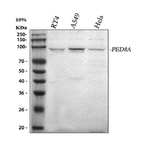 Western blot analysis of PDE8A using anti-PDE8A antibody (A05304-1)