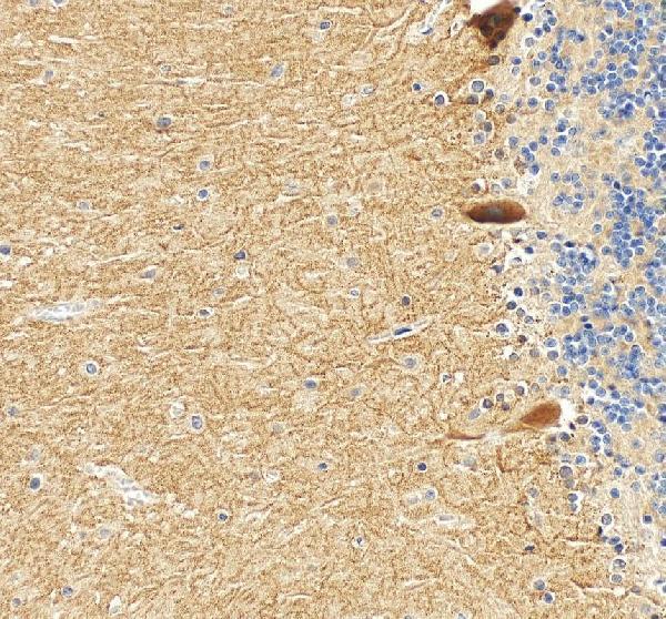 a05305 2 grid2 primary antibodies ihc testing 5