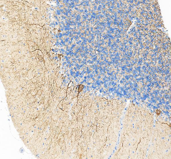 IHC analysis of Nefh using anti-Nefh antibody (A05307)