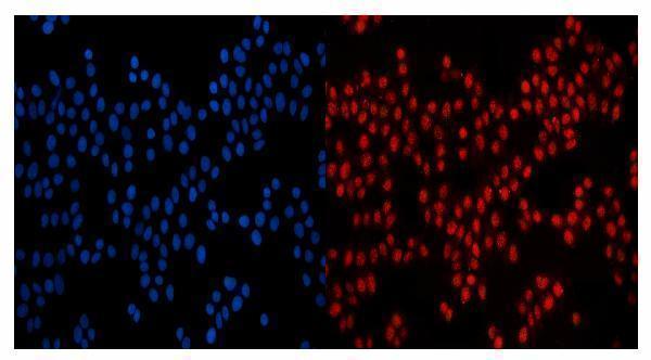 a05308 nup210 primary antibodies if testing 5