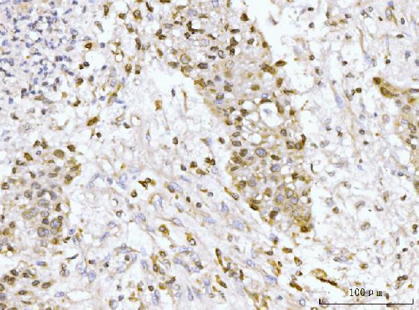  IHC analysis of GP210/NUP210 using anti-GP210/NUP210 antibody (A05308)