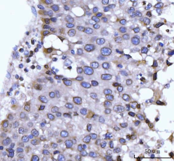  IHC analysis of GP210/NUP210 using anti-GP210/NUP210 antibody (A05308)
