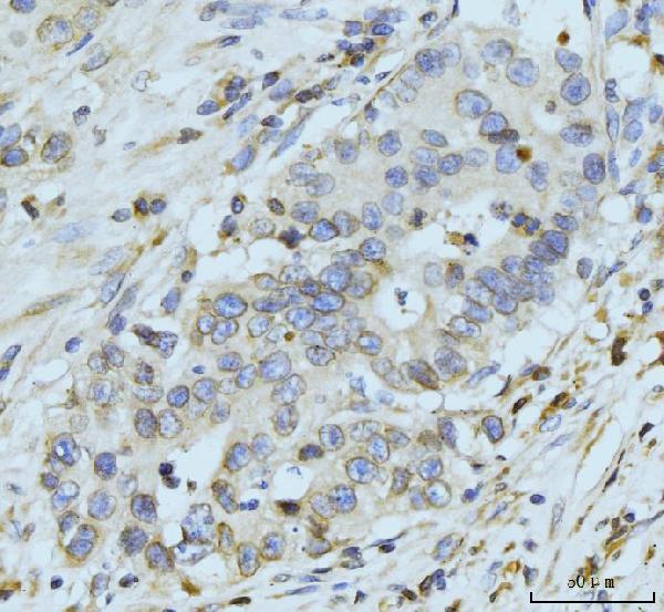 a05308 nup210 primary antibodies ihc testing 4