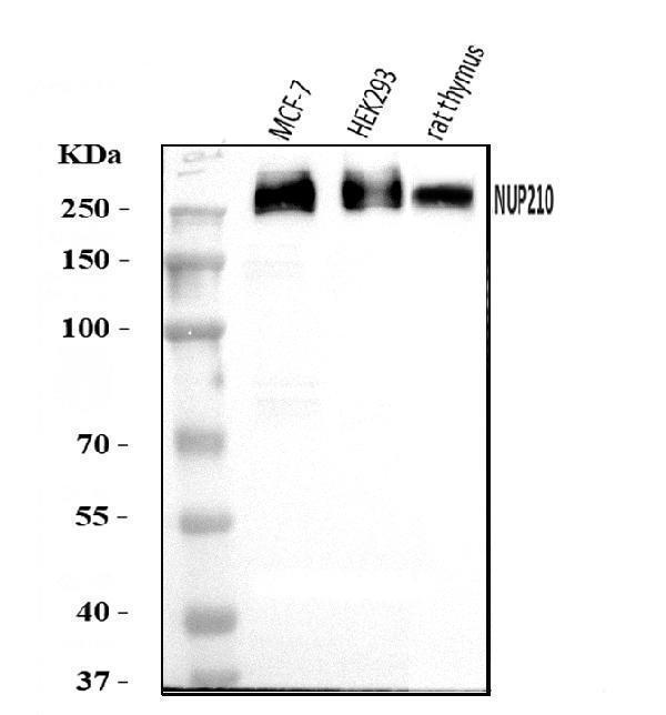  Western blot analysis of GP210/NUP210 using anti-GP210/NUP210 antibody (A05308)