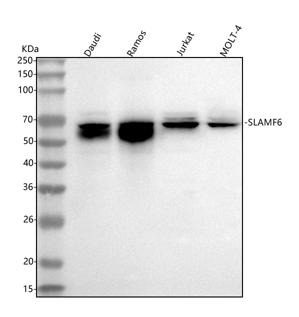  Western blot analysis of SLAMF6 using anti-SLAMF6 antibody (A05310-2)