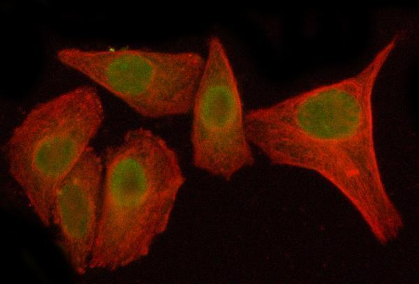  IF analysis of NFKBIZ using anti-NFKBIZ antibody (A05312-1) and anti-Beta Tubulin antibody (M01857-3)